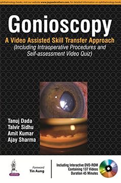 portada Gonioscopy: A Video Assisted Skill Transfer Approach (Including Intraoperative Procedures and Self-Assessment Video Quiz) (en Inglés)