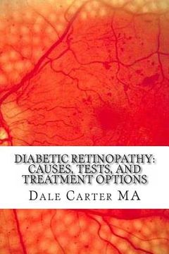 portada Diabetic Retinopathy: Causes, Tests, and Treatment Options (en Inglés)