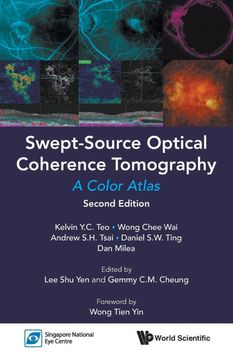 portada Swept-Source Optical Coherence Tomography (en Inglés)