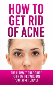 portada How to Get Rid of Acne: The Ultimate Cure Guide for How to Overcome Your Acne Forever (en Inglés)