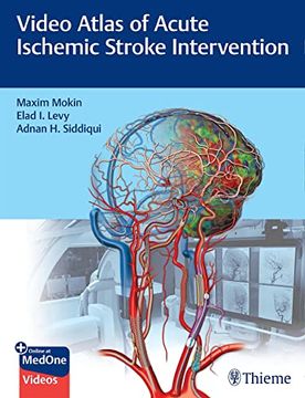 portada Video Atlas of Acute Ischemic Stroke Intervention (en Inglés)