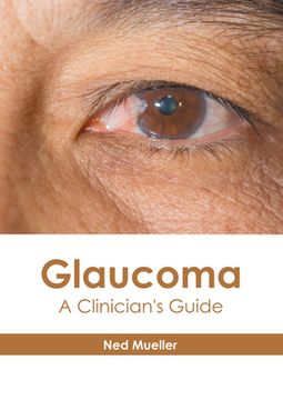portada Glaucoma: A Clinician'S Guide (in English)