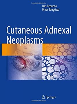 portada Cutaneous Adnexal Neoplasms (in English)