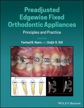 portada Preadjusted Edgewise Fixed Orthodontic Appliances: Principles and Practice (en Inglés)