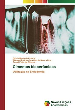 portada Cimentos Biocerâmicos: Utilização na Endodontia (in Portuguese)