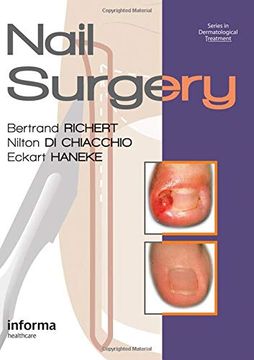 portada Nail Surgery (en Inglés)