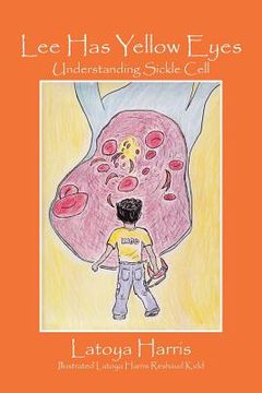 portada Lee Has Yellow Eyes: Understanding Sickle Cell (in English)
