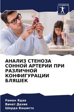 portada АНАЛИЗ СТЕНОЗА СОННОЙ АР (in Russian)