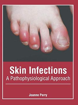 portada Skin Infections: A Pathophysiological Approach (en Inglés)