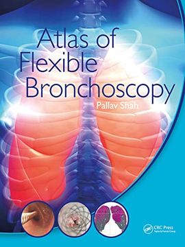 portada Atlas of Flexible Bronchoscopy (en Inglés)