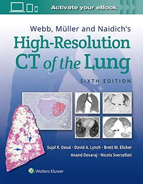 portada Webb, Muller and Naidich'S High Resolution of Lung ct 