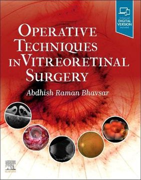 portada Operative Techniques in Vitreoretinal Surgery (in English)