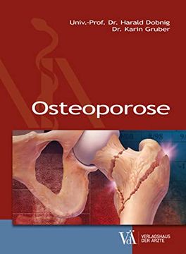 portada Osteoporose (en Alemán)