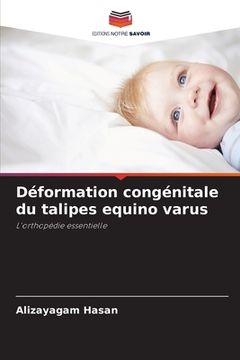 portada Déformation congénitale du talipes equino varus (in French)