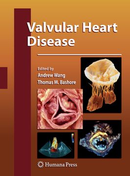 portada Valvular Heart Disease (in English)
