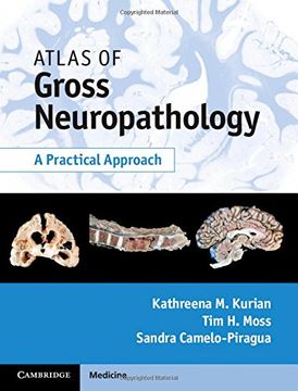 portada Atlas of Gross Neuropathology Book and Online Bundle: A Practical Approach