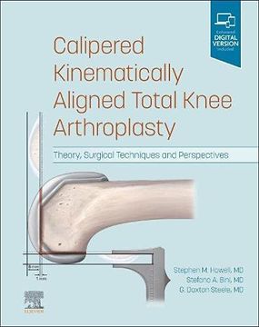portada Calipered Kinematically Aligned Total Knee Arthroplasty: Theory, Surgical Techniques and Perspectives (en Inglés)