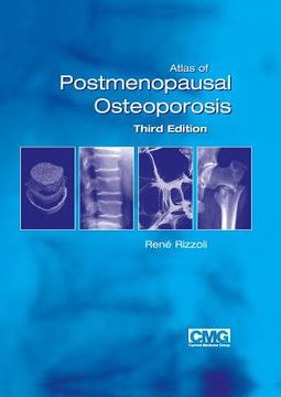 portada atlas of postmenopausal osteoporosis: third edition (en Inglés)