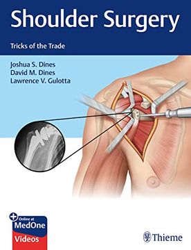 portada Shoulder Surgery: Tricks of the Trade (en Inglés)