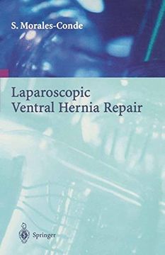 portada laparoscopic ventral hernia repair (in English)