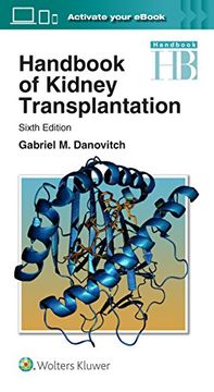 portada Handbook of Kidney Transplantation