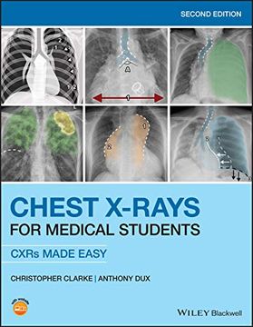 portada Chest X-Rays for Medical Students: Cxrs Made Easy 