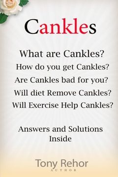portada Cankles: This Guide will answer all of your Cankles questions