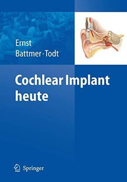 portada Cochlear Implant Heute (en Alemán)
