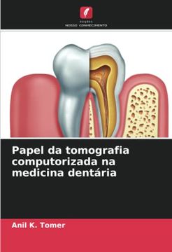 portada Papel da Tomografia Computorizada na Medicina Dentária