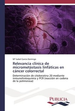 portada Relevancia clínica de micrometástasis linfáticas en cáncer colorrectal: Determinación de citokeratina 20 mediante inmunohistoquimia y PCR (reacción en cadena de la polimerasa)