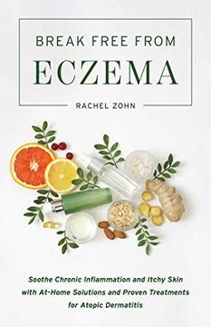 portada Break Free from Eczema: Soothe Chronic Inflammation and Itchy Skin with At-Home Solutions and Proven Treatments for Atopic Dermatitis (en Inglés)