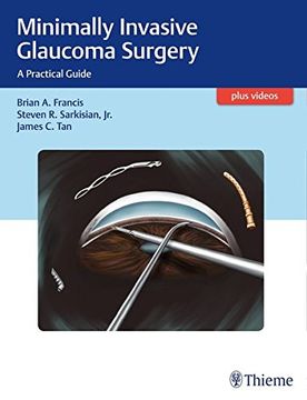 portada Minimally Invasive Glaucoma Surgery: A Practical Guide (en Inglés)