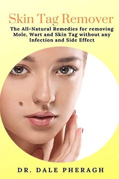 portada Skin tag Remover: The All-Natural Remedies for Removing Mole, Wart and Skin tag Without any Infection and Side Effect