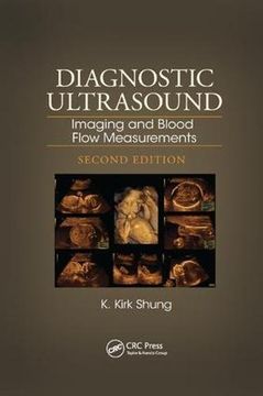 portada Diagnostic Ultrasound: Imaging and Blood Flow Measurements, Second Edition (en Inglés)