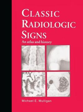portada Classic Radiologic Signs: An Atlas and History (en Inglés)