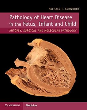 portada Pathology of Heart Disease in the Fetus, Infant and Child: Autopsy, Surgical and Molecular Pathology (en Inglés)