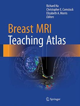 portada Breast mri Teaching Atlas 