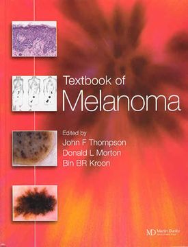 portada Textbook of Melanoma: Pathology, Diagnosis and Management (en Inglés)