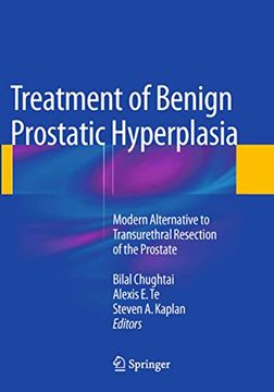 portada Treatment of Benign Prostatic Hyperplasia: Modern Alternative to Transurethral Resection of the Prostate (in English)