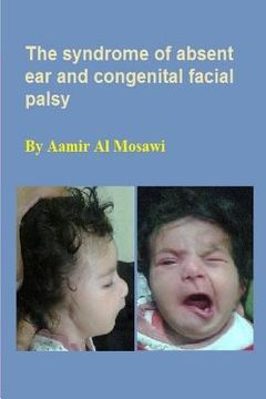 portada The syndrome of absent ear and congenital facial palsy: Clinical dysmorphology (in English)