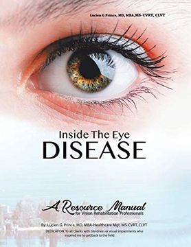 portada Inside the eye Disease Just the Facts: A Resource Manual for the Vision Rehabilitation Professionals (en Inglés)
