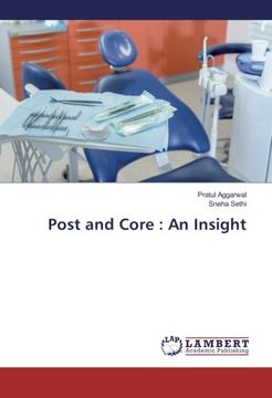 portada Post and Core : An Insight