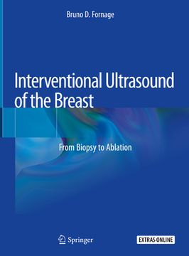 portada Interventional Ultrasound of the Breast: From Biopsy to Ablation (en Inglés)