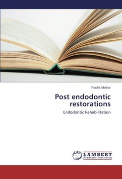 portada Post endodontic restorations