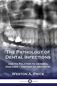 portada The Pathology of Dental Infections: And its Relation to General Diseases - History of Dentistry (in English)