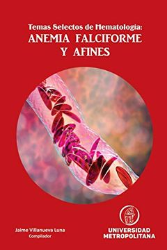 portada Temas Selectos de Hematología: Anemia Falciforme y Afines