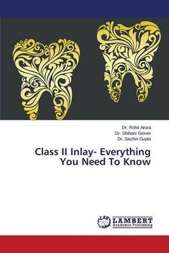 portada Class II Inlay- Everything You Need To Know