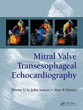 portada Mitral Valve Transesophageal Echocardiography (in English)