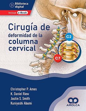 portada Cirugia de la Deformidad de la Columna Cervical