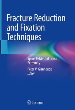 portada Fracture Reduction and Fixation Techniques: Spine-Pelvis and Lower Extremity (in English)